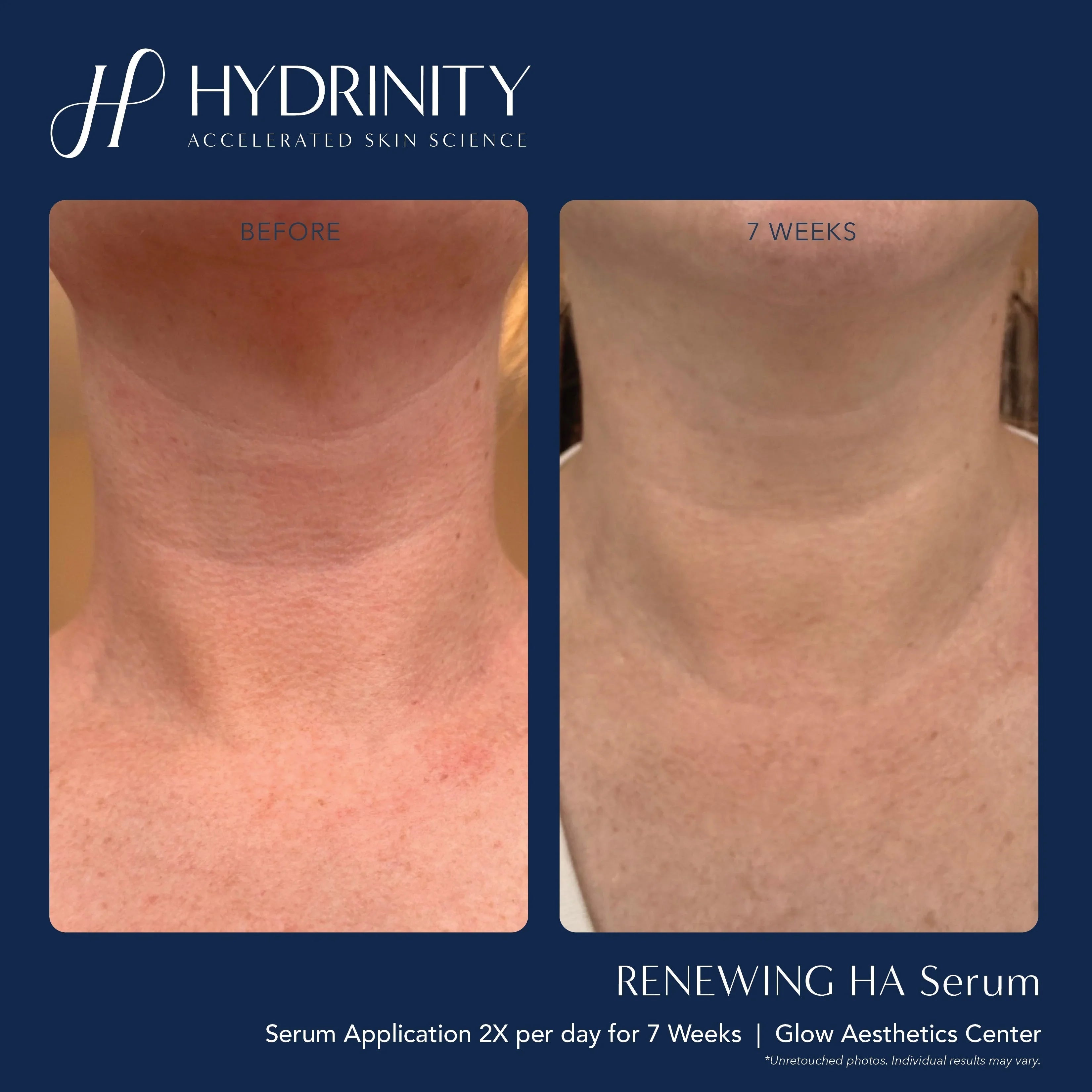 Renewing HA Serum - MariposaSkincare.com