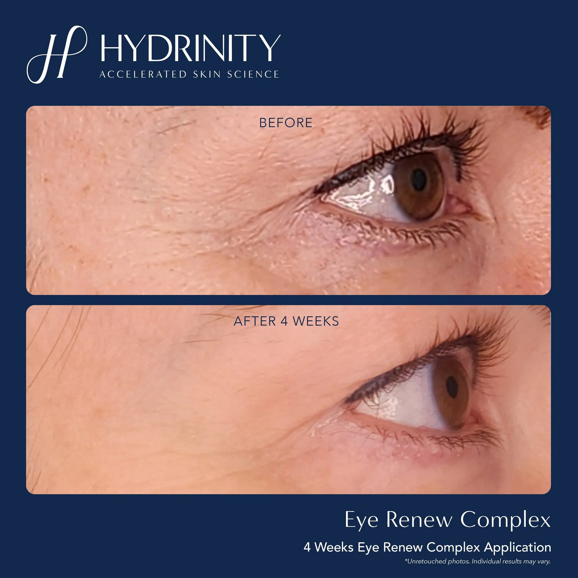 Eye Renew Complex - MariposaSkincare.com