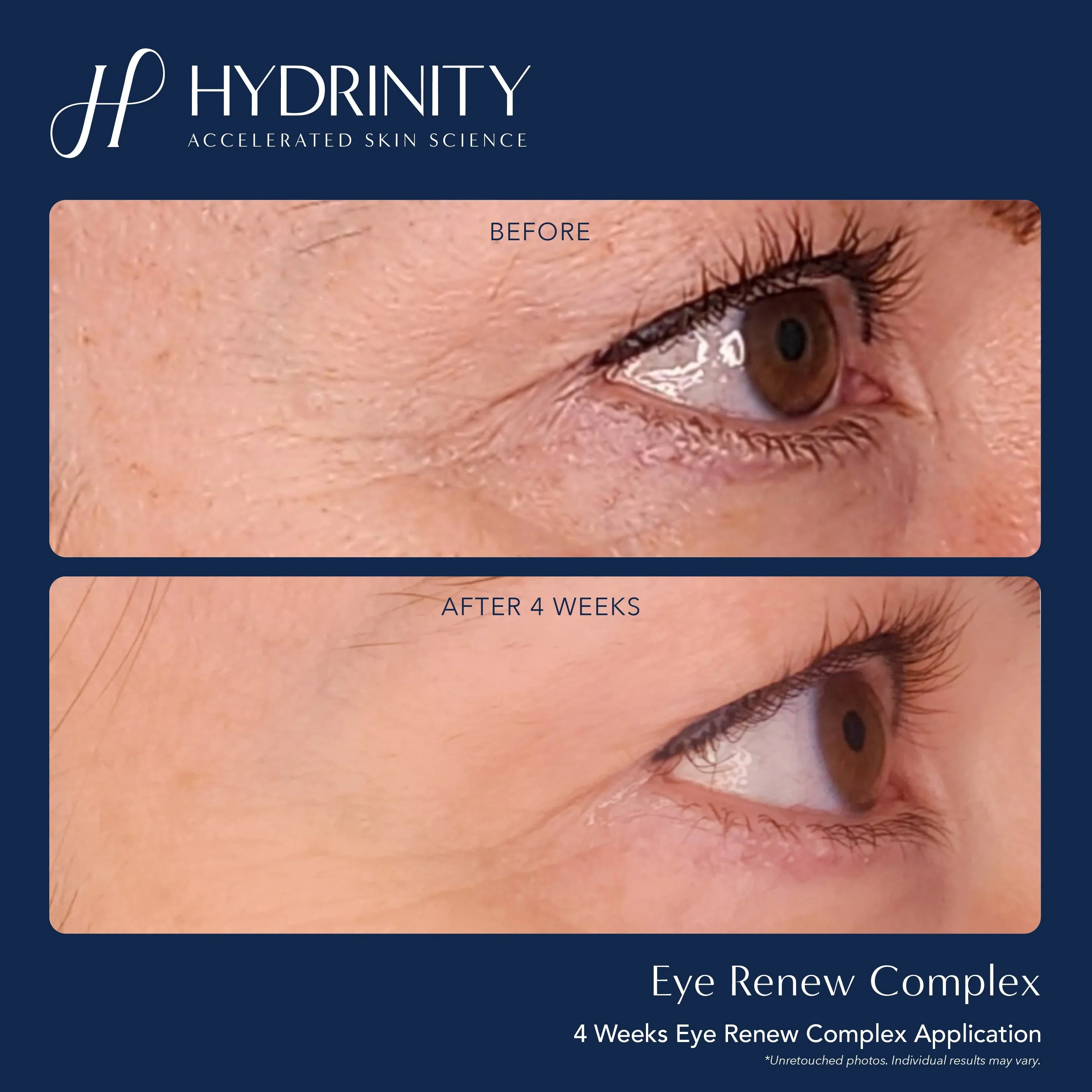 Eye Renew Complex - MariposaSkincare.com