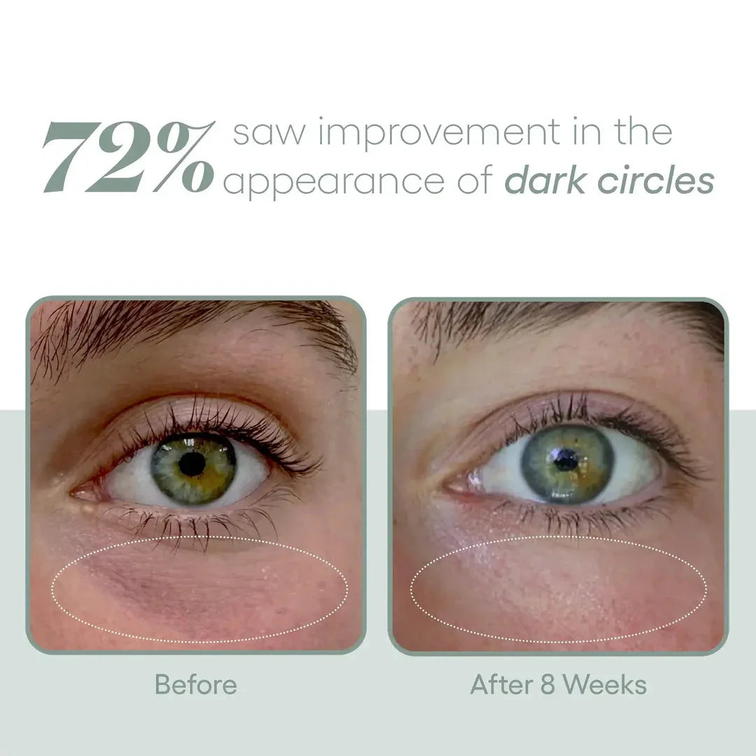 ( plated )™ EYE Serum for Bright and Youthful Eyes