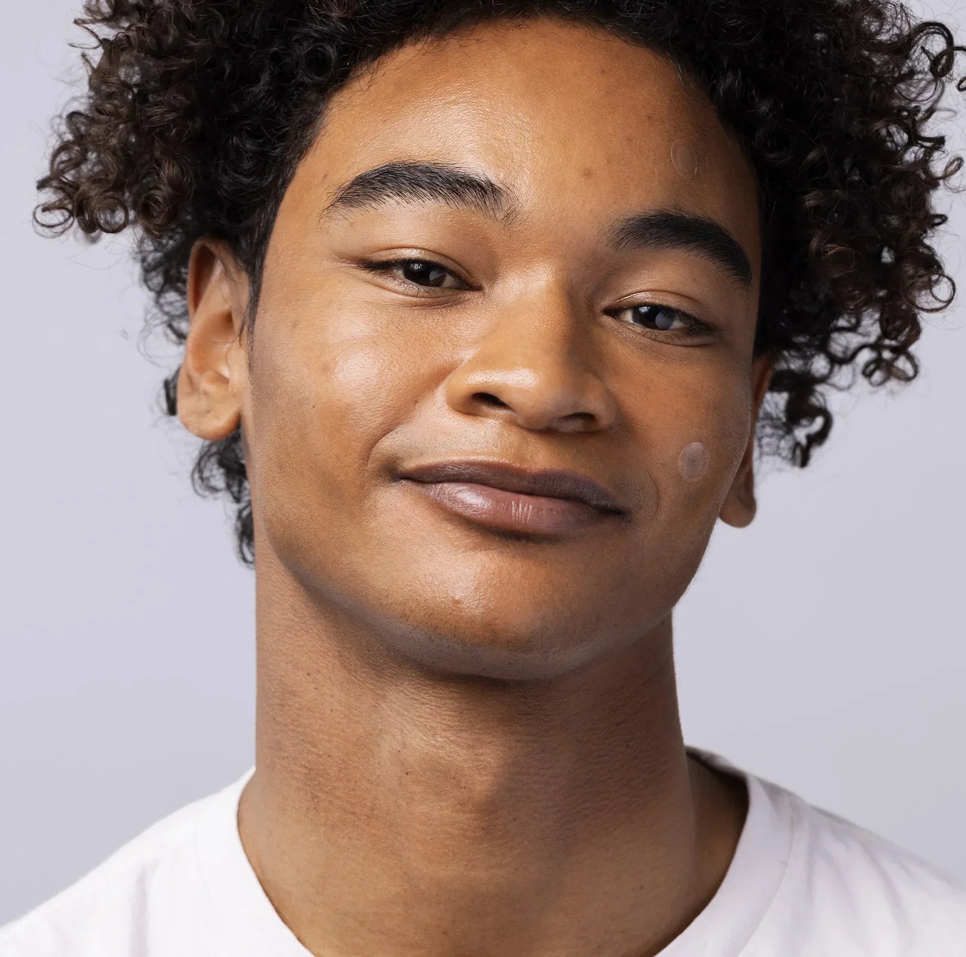Young person with acne patches on face, skincare spot treatment, close-up