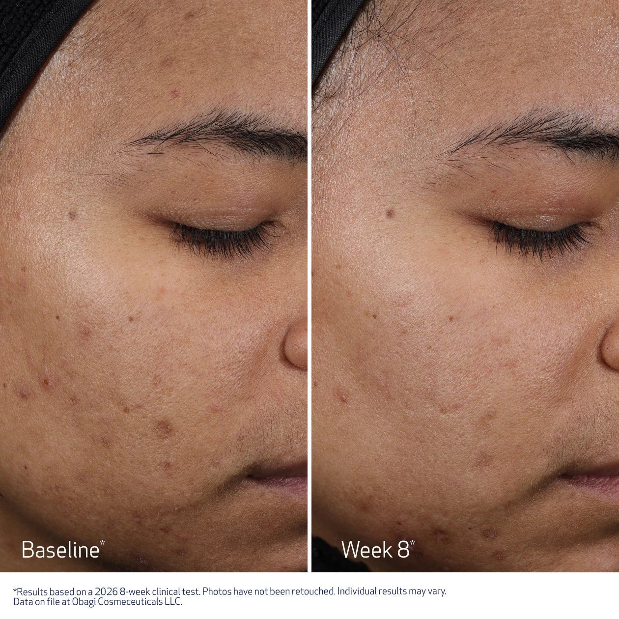 Obagi Medical ClenziDerm M.D. Resurfacing Multi-Acid Peel Pads