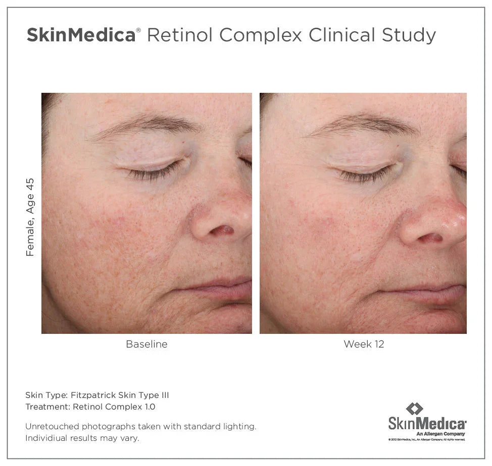 Retinol Complex 1.0 - MariposaSkincare.com