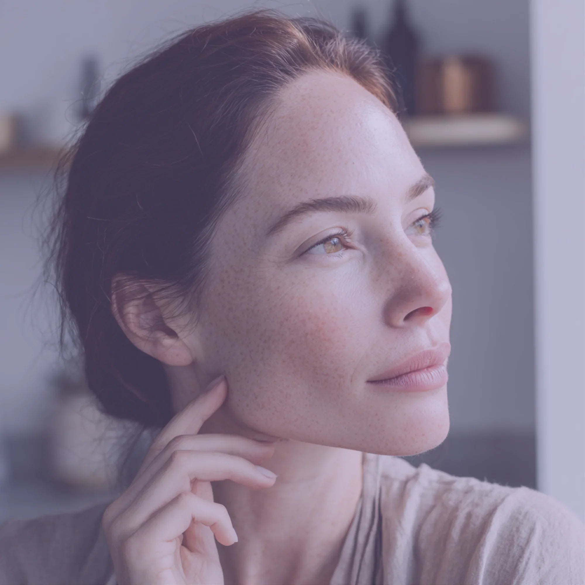 Secret RF Microneedling