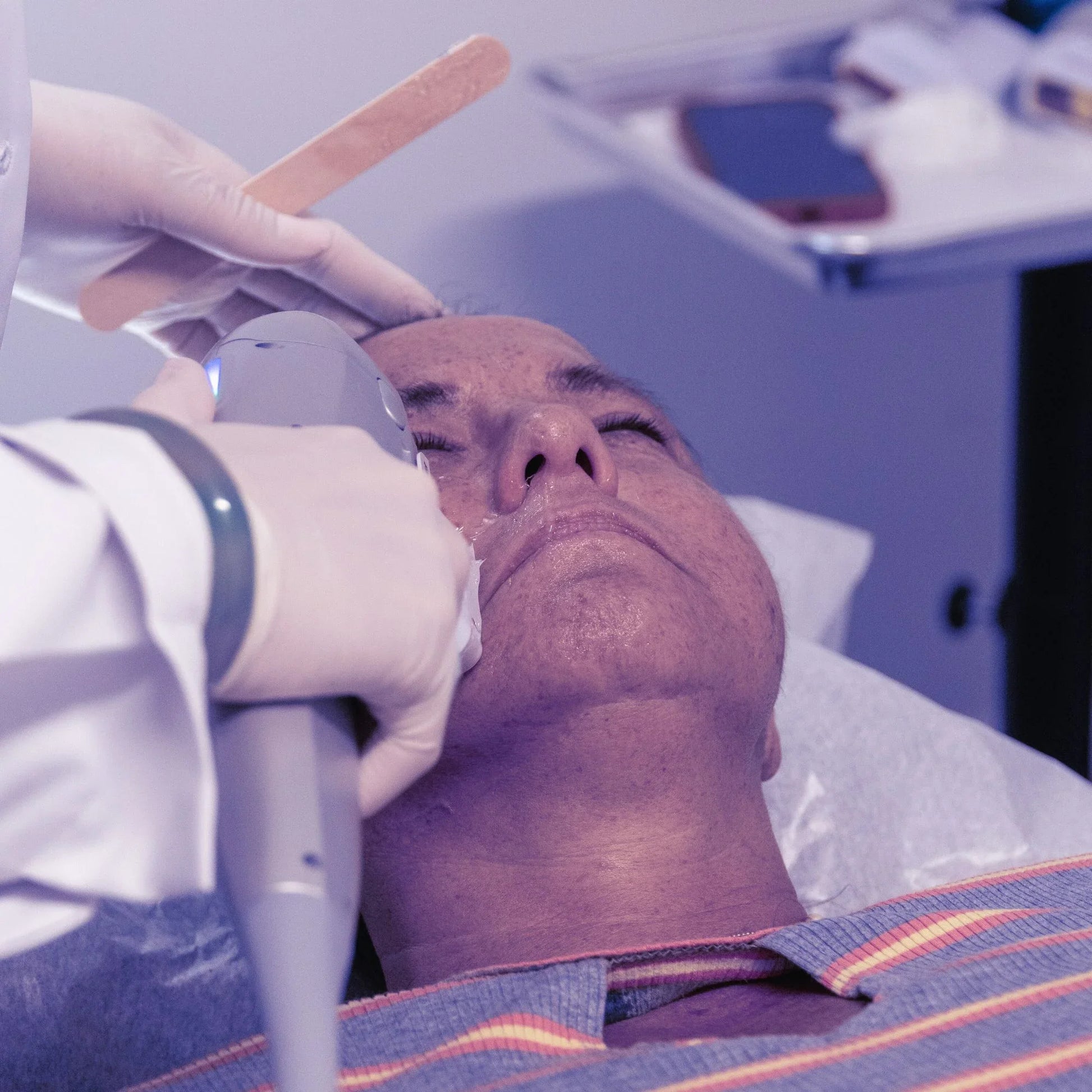 CO2 Laser Resurfacing Revive Combo + Free Secret RF Neck & Hands (Feb 1-28)