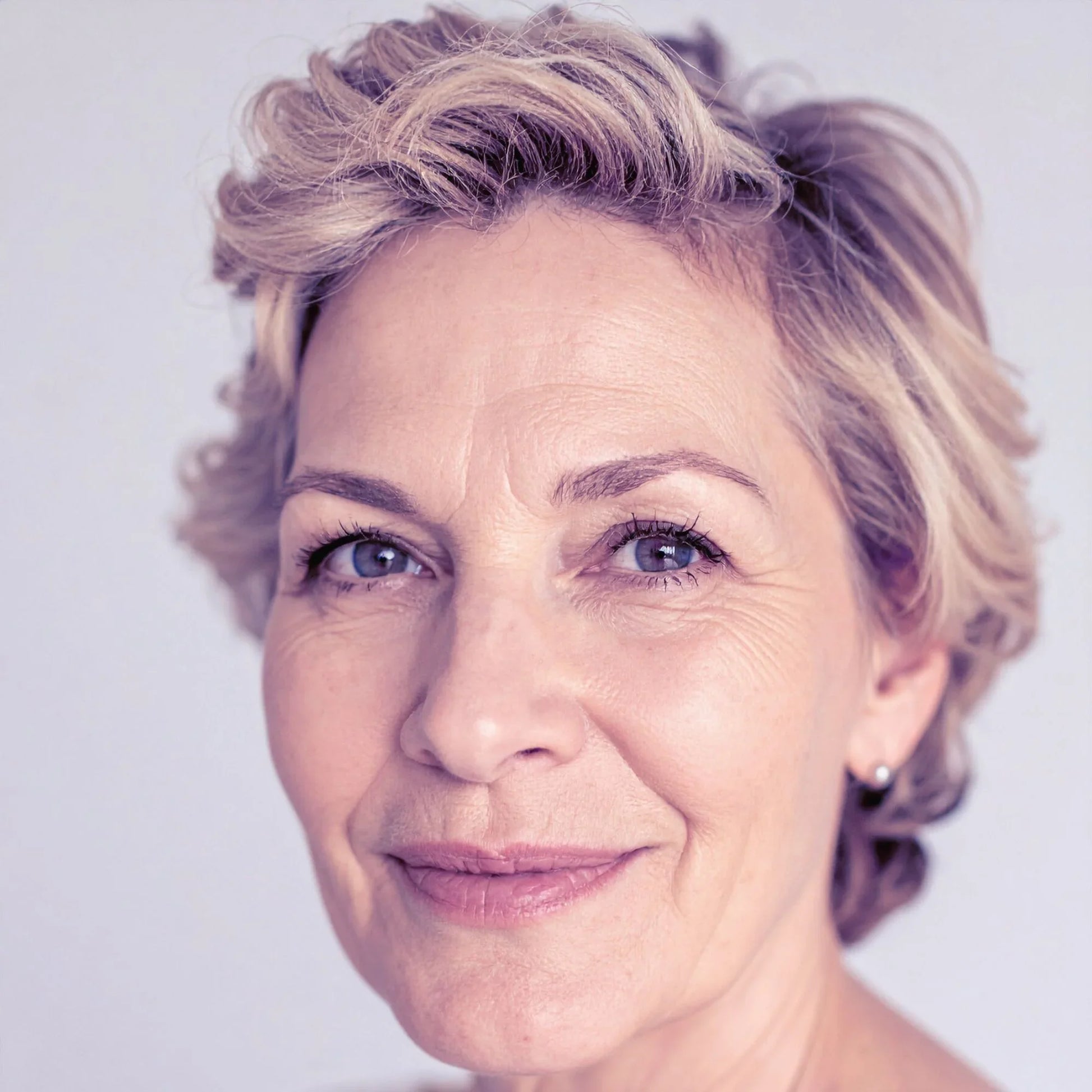 CO2 Ultra Light Laser Resurfacing: Purchase a Package of 3 Treatments & Free Secret RF Neck & Hands (Feb 1-28)