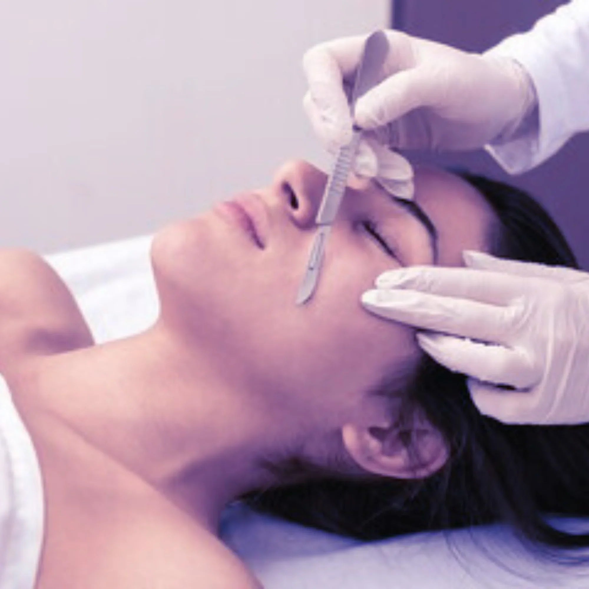 Dermaplaning
