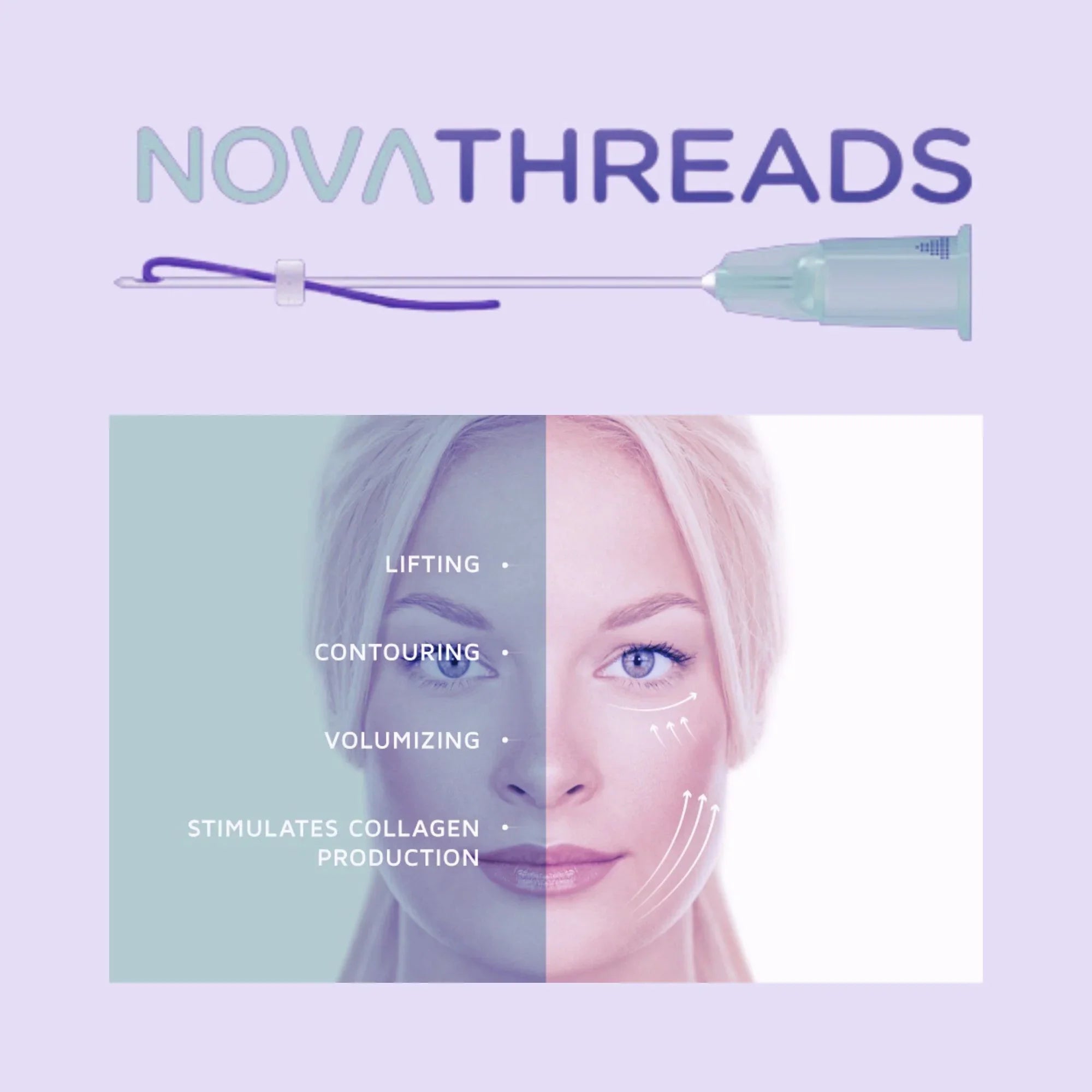 NovaThreads
