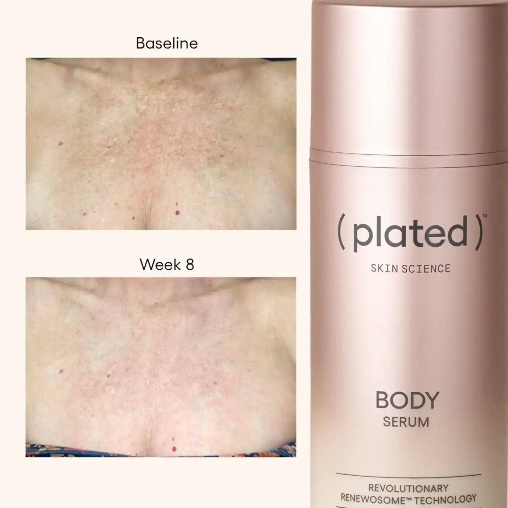 Plated Skin Science Body Serum before and after results showing improved skin texture at Week 8
