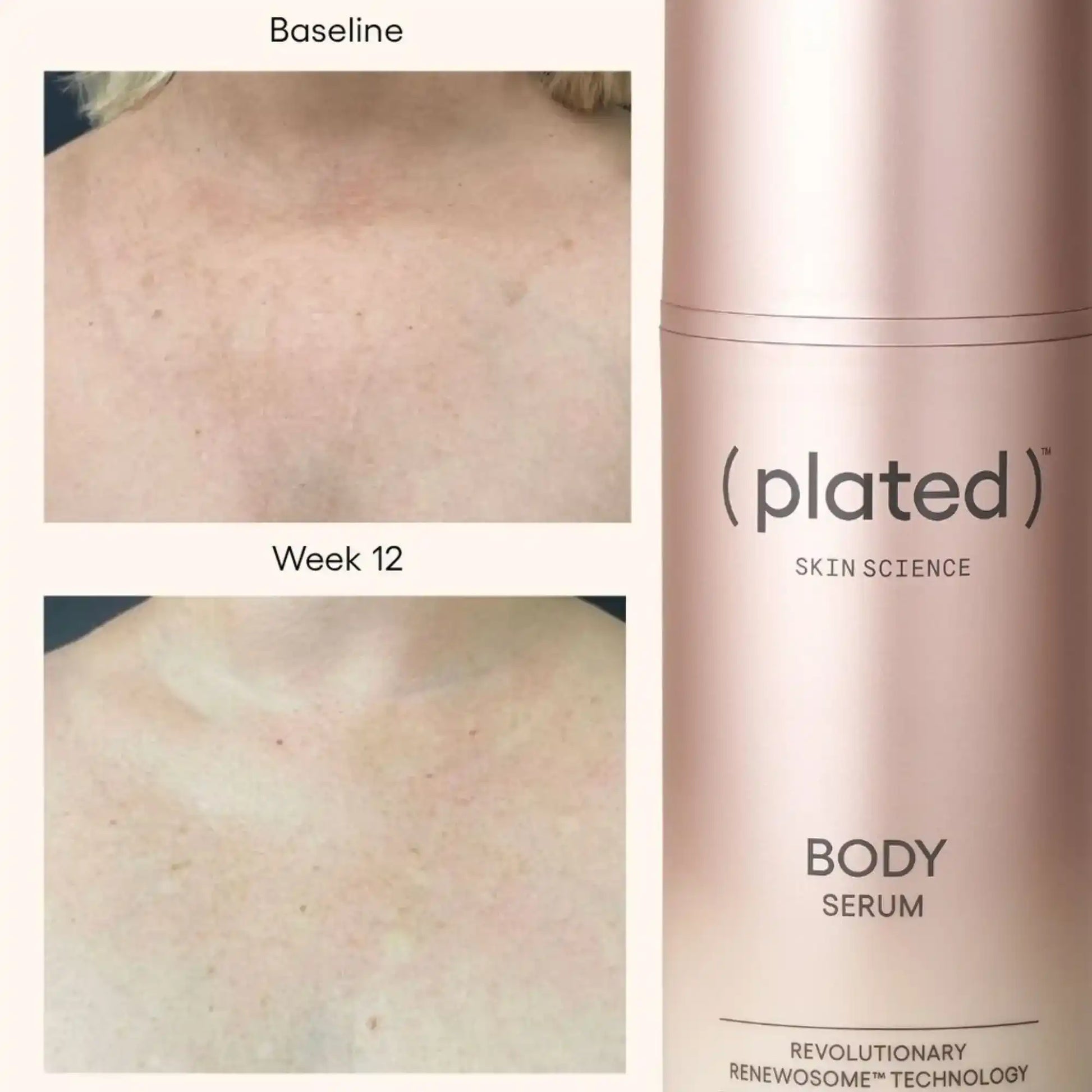 Plated Skin Science Body Serum with before and after skin results showcasing improved texture