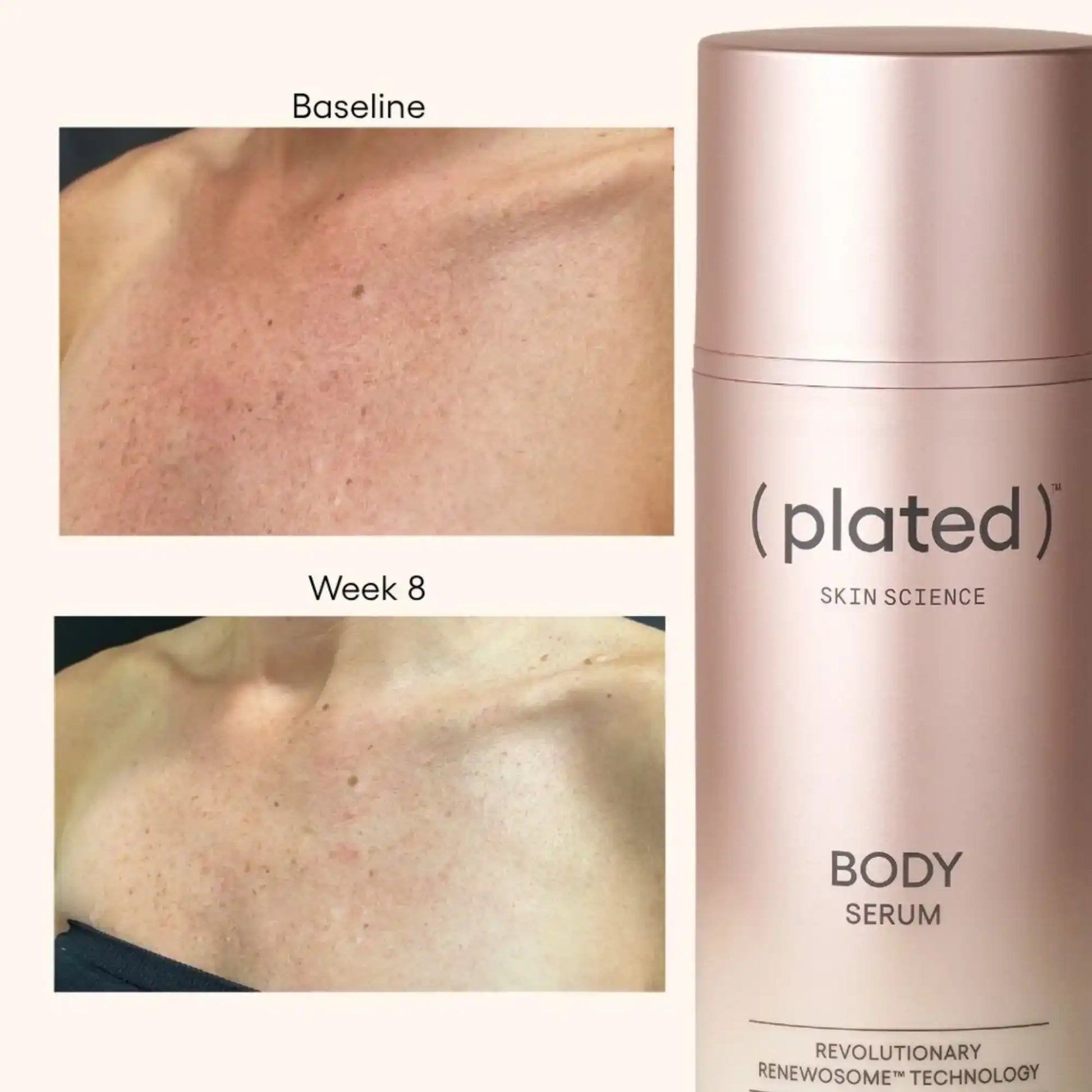 Plated Skin Science Body Serum with before and after skin texture results