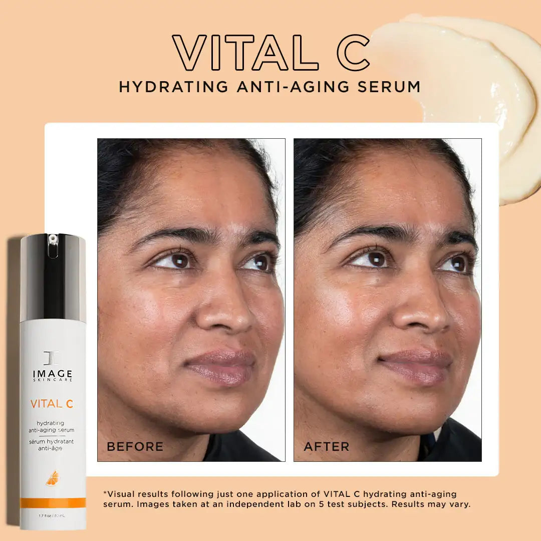 Vital C hydrating anti-aging serum before and after results on woman's face