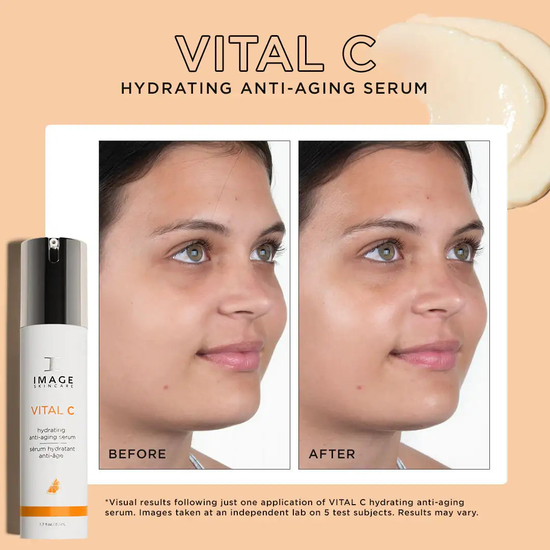 Vital C hydrating anti-aging serum before and after results on young woman's face