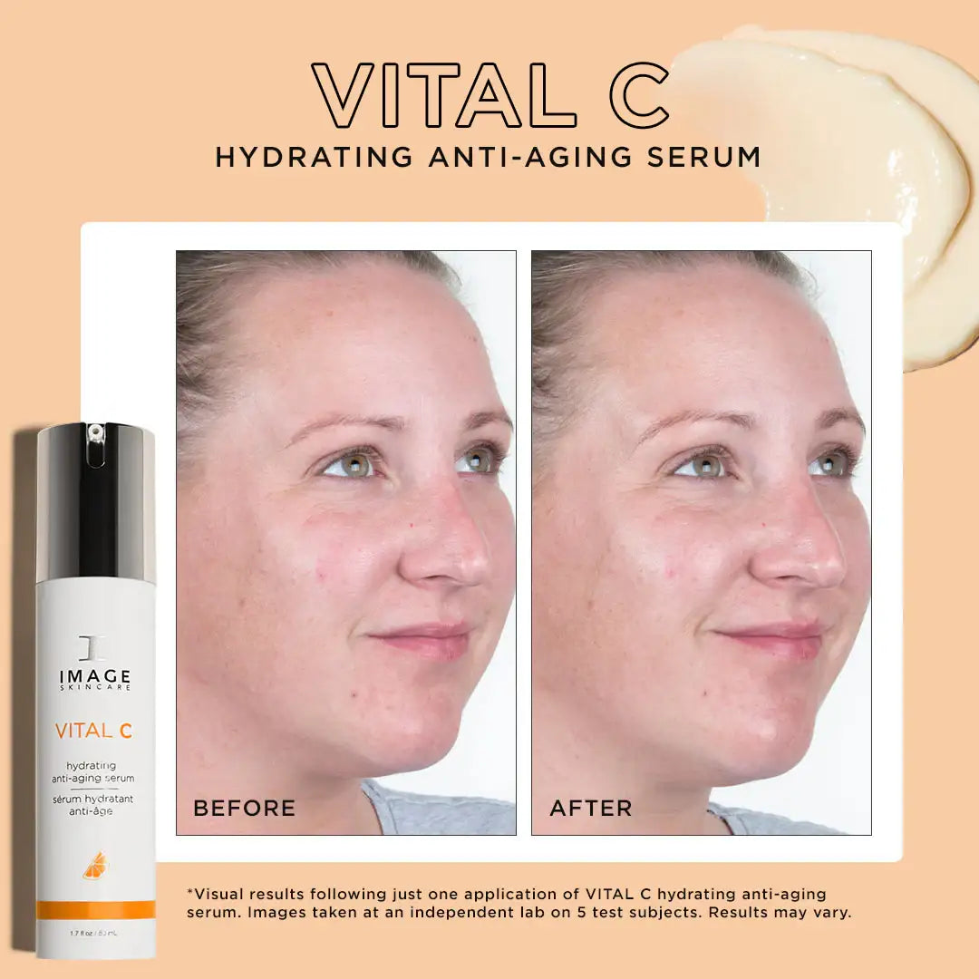 Vital C hydrating anti-aging serum before and after results on woman's face