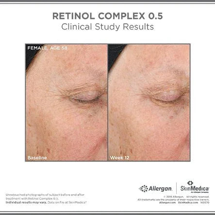 Retinol Complex 0.5 - MariposaSkincare.com