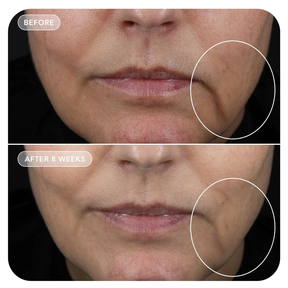 IMAGE Skincare VOL.U.LIFT GLP-1 4D Skin Rebound Complex