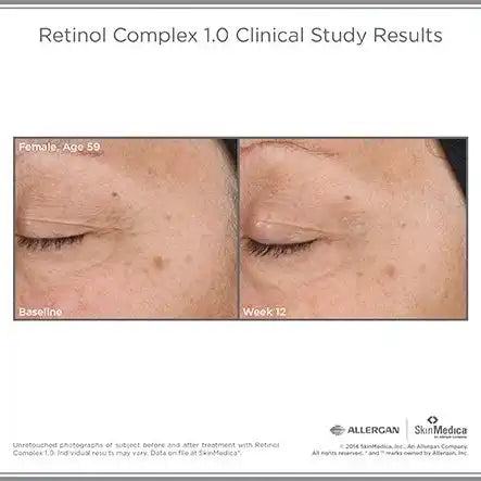 SkinMedica Retinol Complex 1.0%