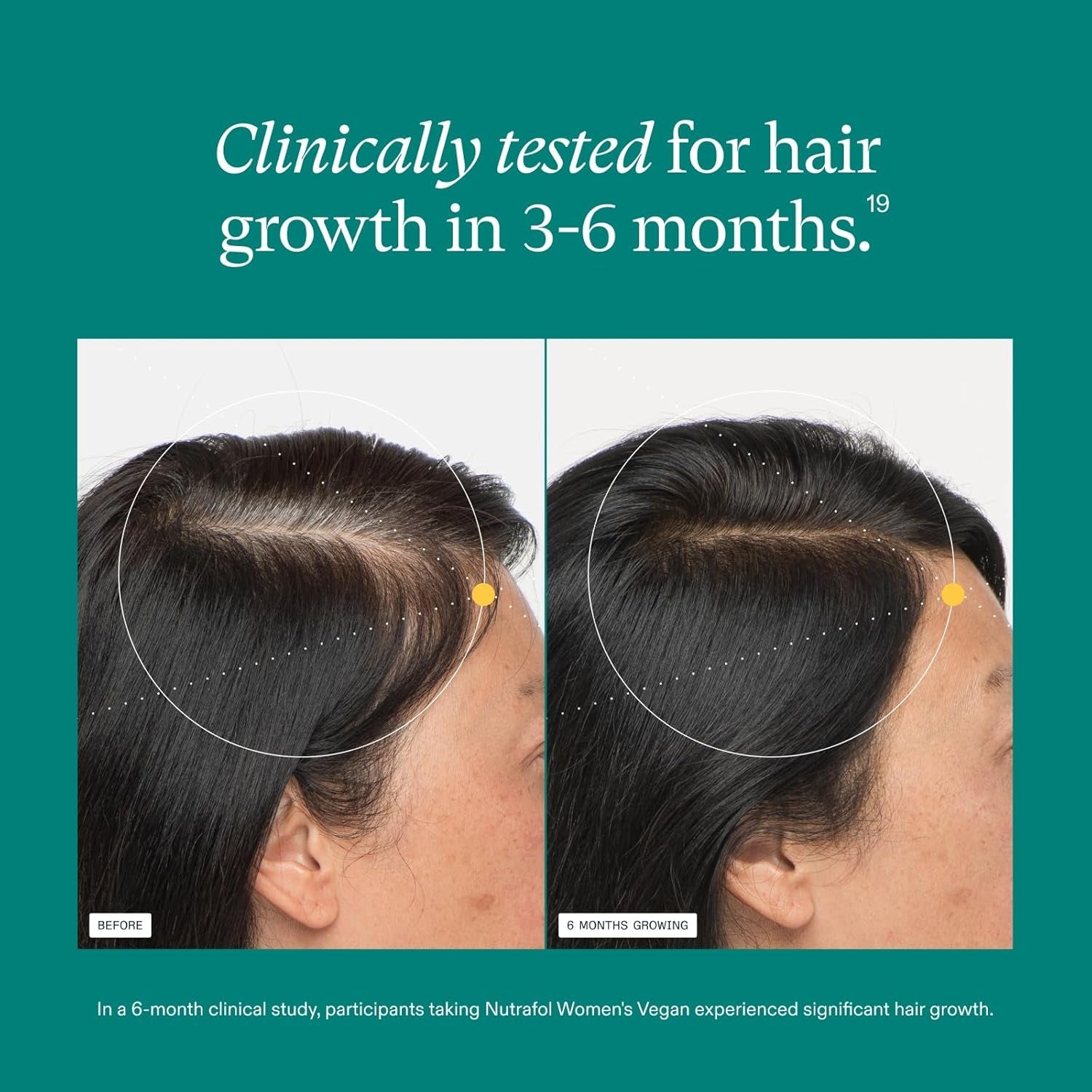 Nutrafol WOMEN'S VEGAN Hair Growth Supplements - 1 MONTH SUPPLY