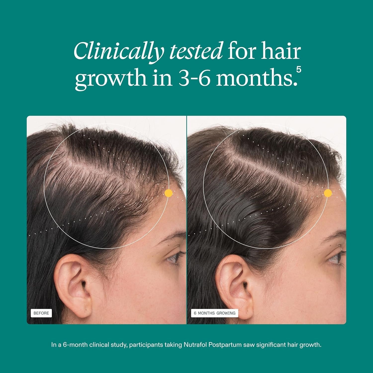 Nutrafol Postpartum Hair Growth Supplement - 3 MONTH SUPPLY