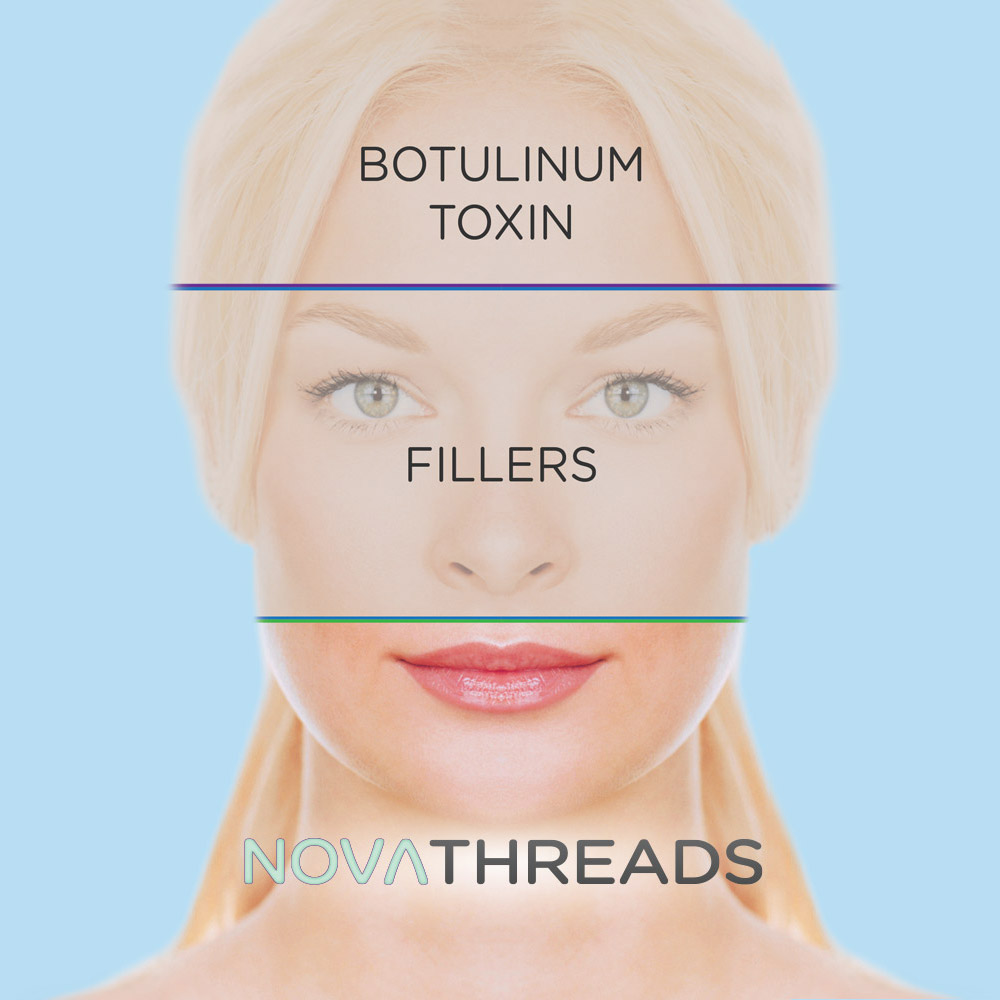 Mariposa Aesthetics & Laser Center NovaThreads PDO Suture Lift