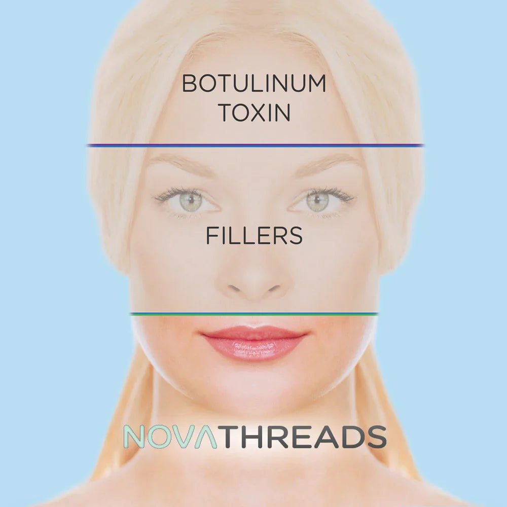 Mariposa Aesthetics & Laser Center NovaThreads PDO Suture Lift