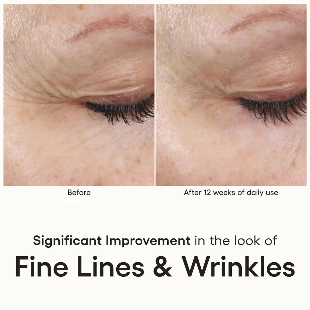 ( plated )™ INTENSE Serum for Anti-Aging