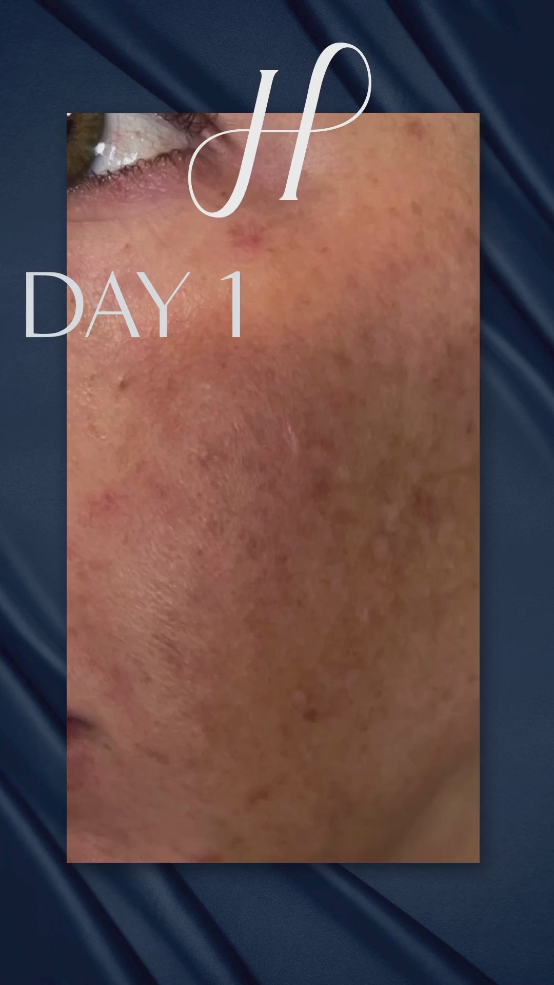 Load video: Hydrinity Glowing Skin with VIVID Brightening Serum